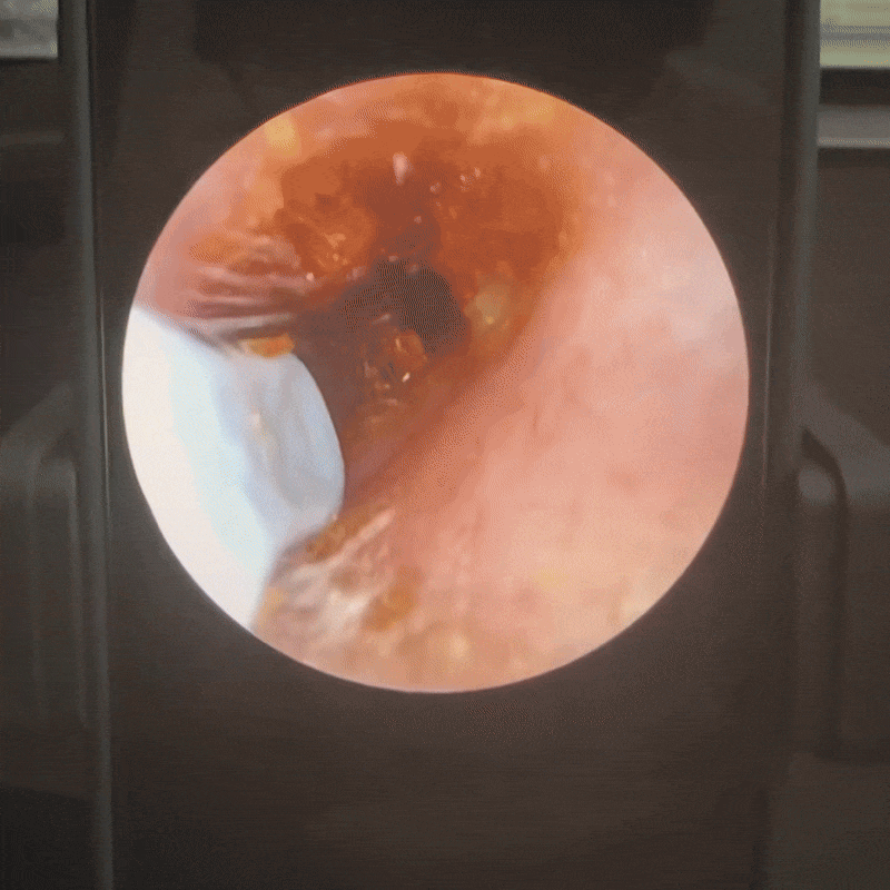 98Steps™VisioEar: Doctor Approved Ear Health Technology